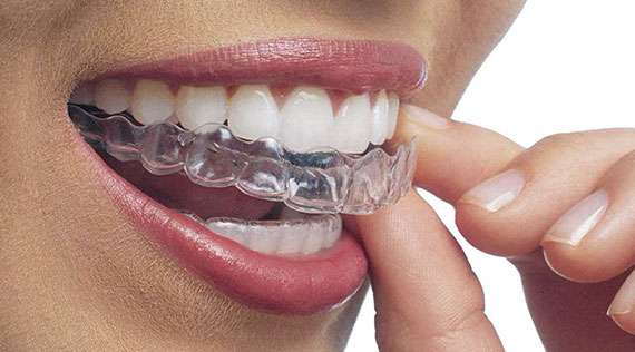 What does Invisalign cost Watercress Dental Clinic, Dentist in Alton Hampshire